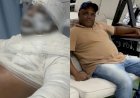 Homem morre após ser atacado com óleo no fervente pela sobrinha em Uruaçu