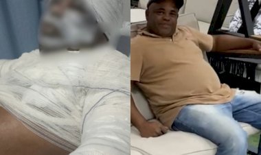 Homem morre após ser atacado com óleo no fervente pela sobrinha em Uruaçu