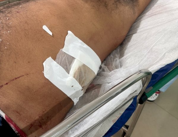 ⚡️3º BPM/12º CRPM PRENDE HOMEM POR LESÃO CORPORAL DOLOSA COM INSTRUMENTO PERFUROCORTANTE EM PORANGATU ⚡