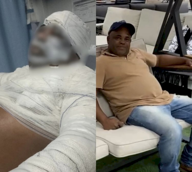 Homem morre após ser atacado com óleo no fervente pela sobrinha em Uruaçu